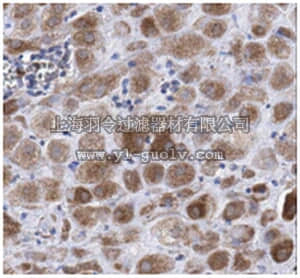 merck millipore,默克密理博,MABN119,Anti-KLF6 Antibody, clone 12A8.3