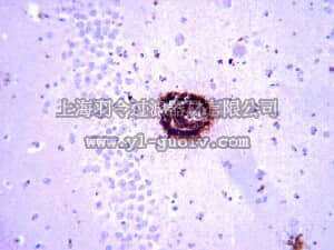 merck millipore,默克密理博,MABN11,Anti-Amyloid β40 Antibody, clone G2-10