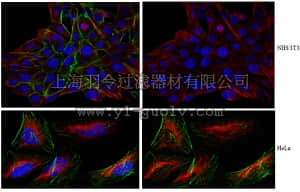merck millipore,默克密理博,MABN123,Anti-S100A7 Antibody, clone 14F6.1