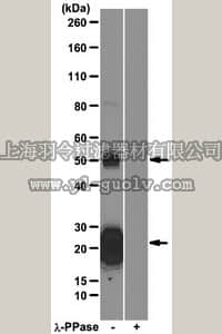 merck millipore,默克密理博,MABN14,Anti-phospho TDP-43 (Ser409/Ser410) Antibody, clone 1D3
