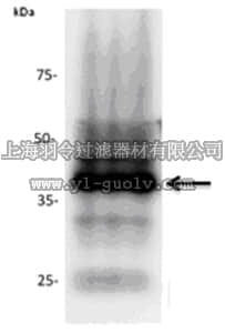 merck millipore,默克密理博,MABN150,Anti-TAR DNA binding protein-43 Antibody, clone TAR5 2H4