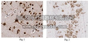 merck millipore,默克密理博,MABN153,Anti-HuC/HuD Antibody, clone 15A7.1