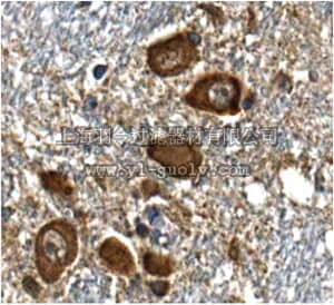 merck millipore,默克密理博,MABN250,Anti-RA-induced protein 17 Antibody, clone 5H5.1