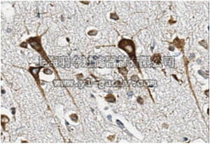 merck millipore,默克密理博,MABN279,Anti-Beta-mannosidase Antibody, clone 1B3.1