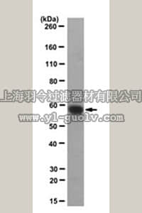 merck millipore,默克密理博,MABN304,Anti-Monoamine oxidase type B(MAO-B) Antibody, clone 3F12/G10/2E3