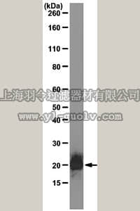 merck millipore,默克密理博,MABN31,Anti-alpha B-crystallin Antibody, clone CPTC-CRYAB-1