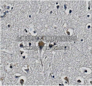 merck millipore,默克密理博,MABN371,Anti-KChIP2 potassium channel subunit Antibody, clone 60/73