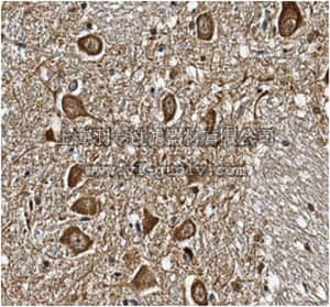 merck millipore,默克密理博,MABN377,Anti-Eag1 Potassium Channel Antibody, clone 62