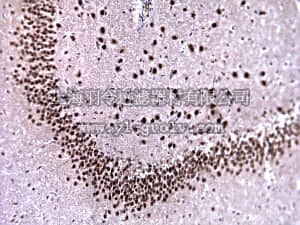 merck millipore,默克密理博,MABN37,Anti-Ataxin-1 Antibody, 11NQ, clone N76/8