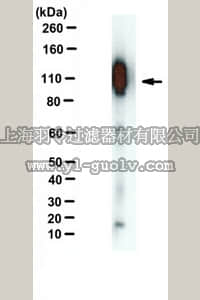 merck millipore,默克密理博,MABN381,Anti-APP-C99 Antibody, clone mC99(1-7)