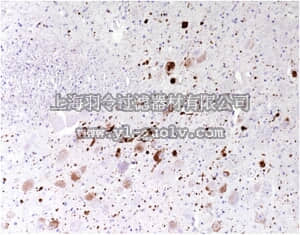 merck millipore,默克密理博,MABN389,Anti-Aggregated a-Synuclein Antibody, clone 5G4