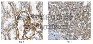 merck millipore,默克密理博,MABN457,Anti-Mitochondrial dicarboxylate carrier Antibody, clone 1F5.1