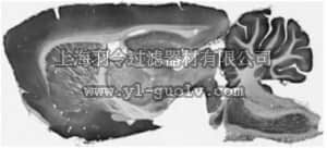 merck millipore,默克密理博,MABN462,Anti-ASIC1 Antibody, clone N271/44
