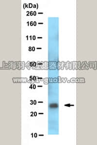merck millipore,默克密理博,MABN467,Anti-DLX-1 Antibody, clone L43/40