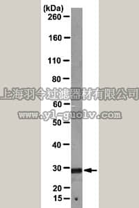 merck millipore,默克密理博,MABN46,Anti-Chloride intracellular channel protein (CLIC1) Antibody, clone CPTC-CLIC1-1