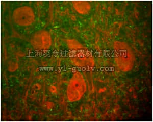 merck millipore,默克密理博,MABN48,Anti-UCHL1 Antibody, clone MCA-BH7