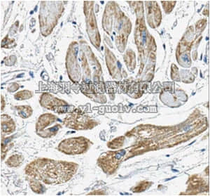 merck millipore,默克密理博,MABN504,Anti-VDAC1 Antibody, clone N152B/23
