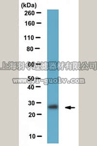 merck millipore,默克密理博,MABN518,Anti-Tafazzin Antibody, clone N173B/13