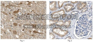 merck millipore,默克密理博,MABN606,Anti-Laforin Antibody, clone N84/37