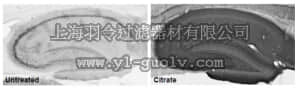 merck millipore,默克密理博,MABN611,Anti-Lgi1 Antibody, clone N283/7