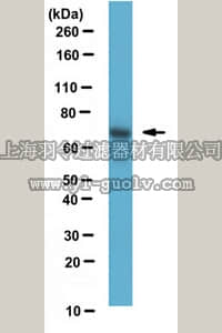 merck millipore,默克密理博,MABN615,Anti-Pan-GRK Antibody, clone N145/20