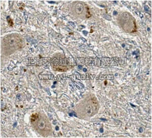 merck millipore,默克密理博,MABN636,Anti-LRRK2 Antibody, clone 8G10