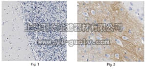 merck millipore,默克密理博,MABN654,Anti-SCN4B Antibody, clone N168/6