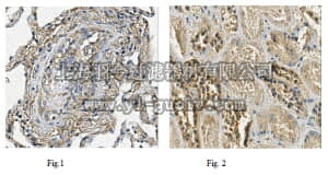 merck millipore,默克密理博,MABN721,Anti-PTK7 Antibody, clone 4F9
