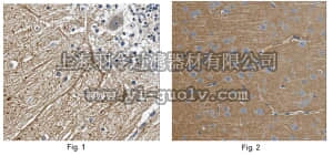 merck millipore,默克密理博,MABN740,Anti-GABA-B receptor 2 Antibody, clone N81/37