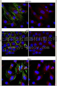 merck millipore,默克密理博,MABS10,Anti-NEDD8-conjugating enzyme Ubc12 Antibody, clone 9H1.1