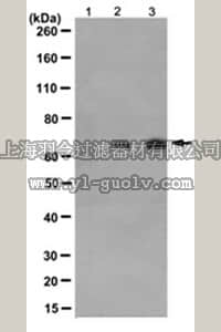 merck millipore,默克密理博,MABS155,Anti-phospho-GRK2 (Ser670) Antibody, clone 15G11.1