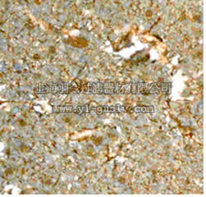 merck millipore,默克密理博,MABS166,Anti-Acyl protein thioesterase 1 Antibody, clone EPR3667, rabbit monoclonal