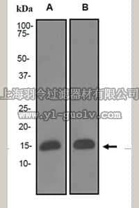 merck millipore,默克密理博,MABS172,Anti-FABP4 Antibody, clone EPR3579, Rabbit,MABS172