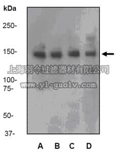 merck millipore,默克密理博,MABS174,Anti-ASIP Antibody, clone EP310Y, rabbit monoclonal