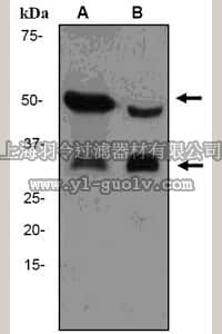 merck millipore,默克密理博,MABS176,Anti-Adiponectin Antibody, clone EPR3217, rabbit monoclonal