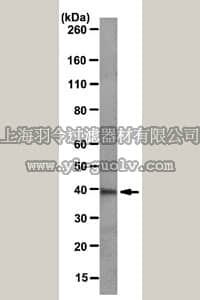 merck millipore,默克密理博,MABS18,Anti-Aldose reductase Antibody, clone CPTC-AKR1B1-1