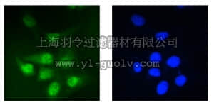 merck millipore,默克密理博,MABS270,Anti-PP2A reg. subunit B56 epsilon (PPP2R5E) Antibody, clone 5A5-1F3