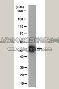 merck millipore,默克密理博,MABS277,Anti-monoglycylated Tubulin Antibody, clone TAP 952
