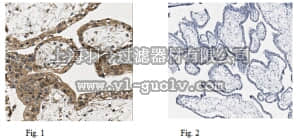 merck millipore,默克密理博,MABS279,Anti-GPR30, clone 2F2 Antibody