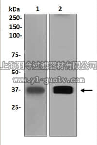 merck millipore,默克密理博,MABS388,Anti-ARG1 Antibody, clone EPR6671(B), rabbit monoclonal