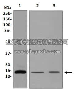 merck millipore,默克密理博,MABS390,Anti-FABP2 Antibody, clone EPR7136, rabbit monoclonal