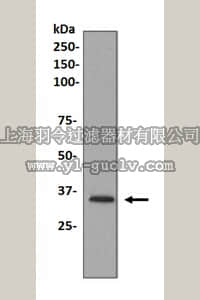 merck millipore,默克密理博,MABS395,Anti-Monoglyceride Lipase Antibody, clone EPR6339, rabbit monoclonal