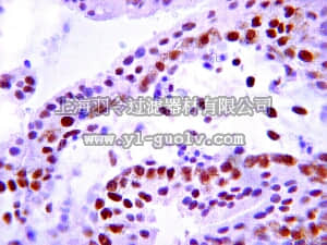 merck millipore,默克密理博,MABS65,Anti-Insulin Receptor Antibody, beta subunit, clone CT-3