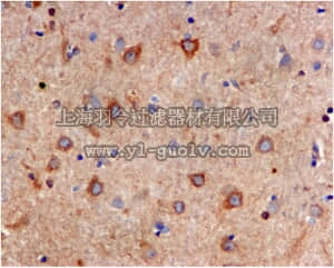 merck millipore,默克密理博,MABS733,Anti-ITPR1, clone EPR4536, Rabbit Monoclonal Antibody