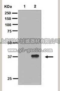 merck millipore,默克密理博,MABS788,Anti-phospho-IkappaB-alpha (Ser36), clone EPR6235(2), Rabbit Monoclonal Antibody