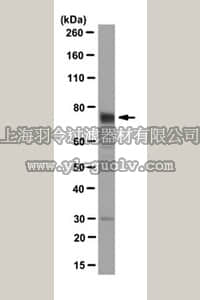 merck millipore,默克密理博,MABT104,Anti-Myotubularin Antibody, clone 9G3.2