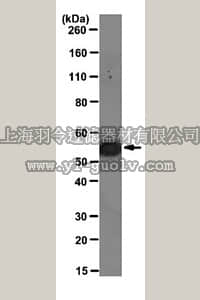 merck millipore,默克密理博,MABT121,Anti-Vimentin Antibody, clone 3CB2