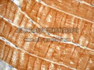 merck millipore,默克密理博,MABT143,Anti-Alpha-Actinin 3 Antibody, clone EP2531Y, rabbit monoclonal