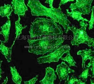 merck millipore,默克密理博,MABT144,Anti-Alpha-Actinin 4 Antibody, clone EPR2533(2), rabbit monoclonal