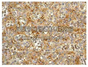 merck millipore,默克密理博,MABT146,Anti-CD97 Antibody, clone EPR4427, Rabbit,MABT146
